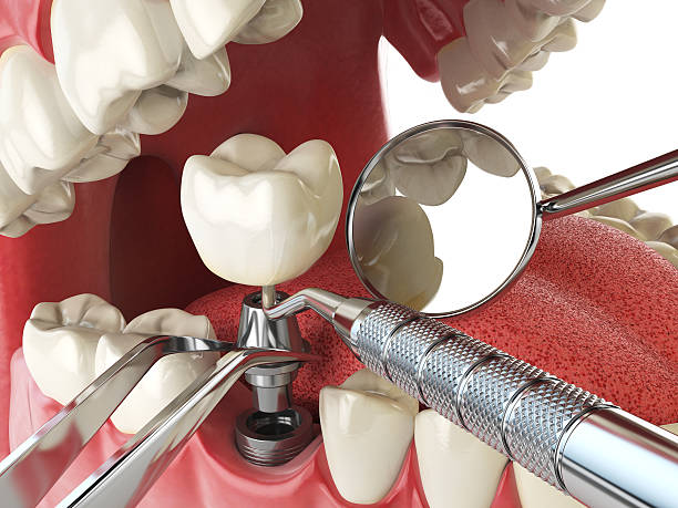 Best Root Canal Emergency Dentist  in Lake Arrowhead, CA